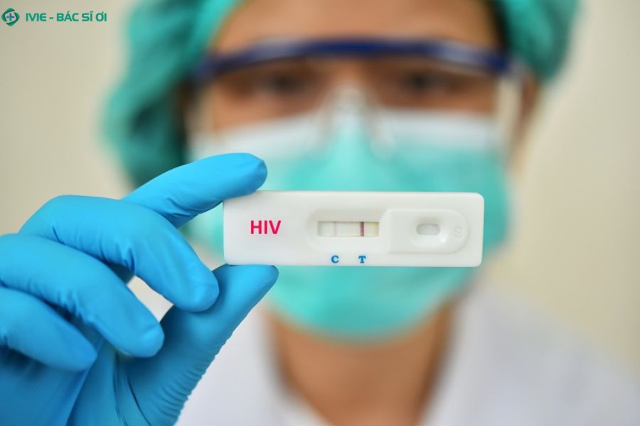 Lý do nên xét nghiệm HIV sớm