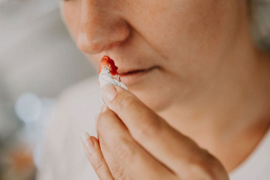 Chảy máu cam có phải là ung thư không?