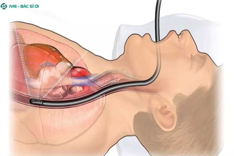 Cách phân biệt các loại nội soi hiện nay