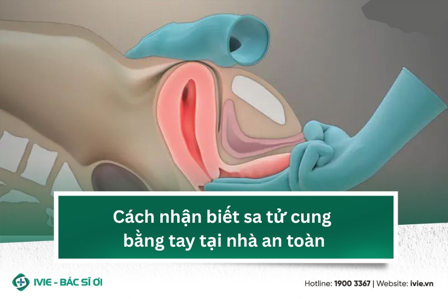 Cách nhận biết sa tử cung bằng tay tại nhà an toàn