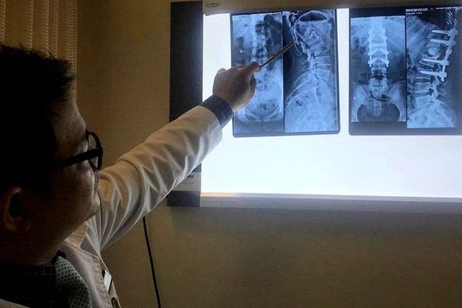 Lao xương có phải ung thư không?