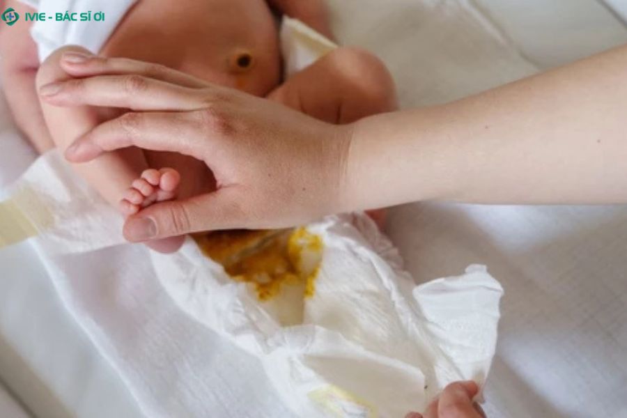 Phân bình thường của trẻ 2 tháng tuổi