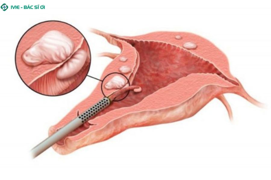 Nhận biết sớm các dấu hiệu biến chứng giúp người bệnh xử lý kịp thời, an toàn