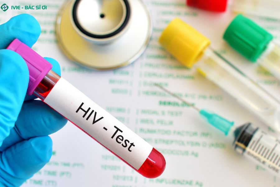 Bị nhiễm HIV bao lâu thì xét nghiệm ra?