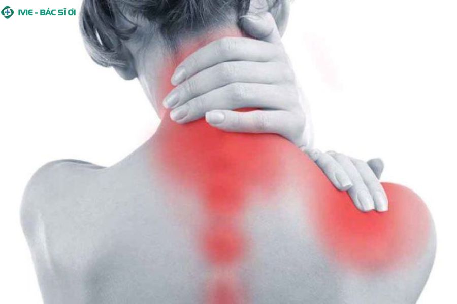 Cứng cổ, đau mỏi và tê lan xuống vai những triệu chứng điển hình của đau cổ vai gáy bên phải 