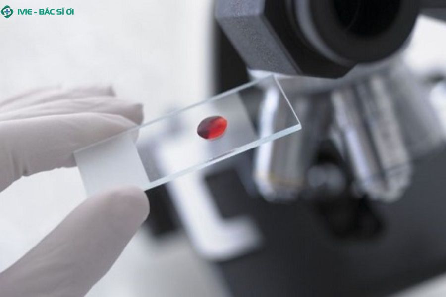 Tìm hiểu các phương pháp xét nghiệm ký sinh trùng an toàn