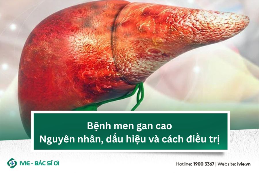 Bệnh men gan cao: Nguyên nhân, dấu hiệu và cách điều trị
