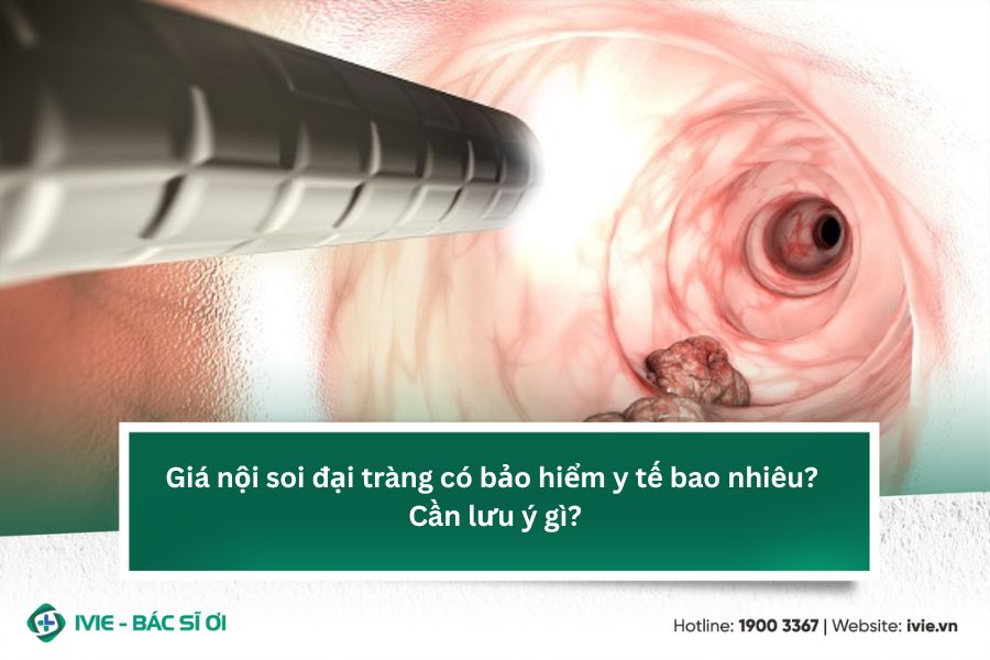 Giá nội soi đại tràng có bảo hiểm y tế bao nhiêu? Cần lưu ý ...