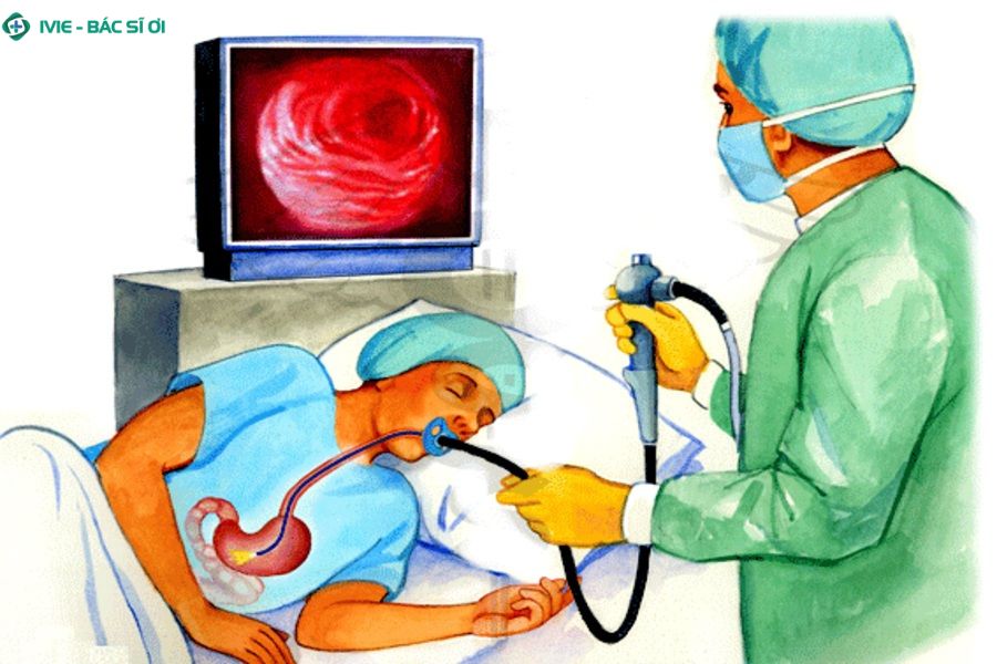 Tìm hiểu về kỹ thuật nội soi dạ dày