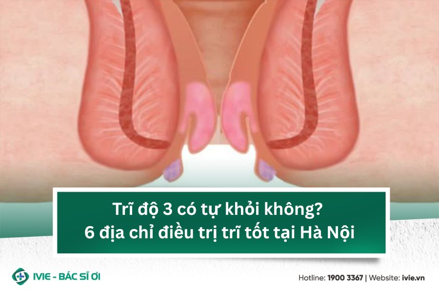 Trĩ độ 3 có tự khỏi không? 6 địa chỉ điều trị trĩ tốt tại...