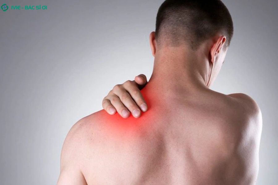 Các triệu chứng đau cổ vai gáy bên trái thường gặp