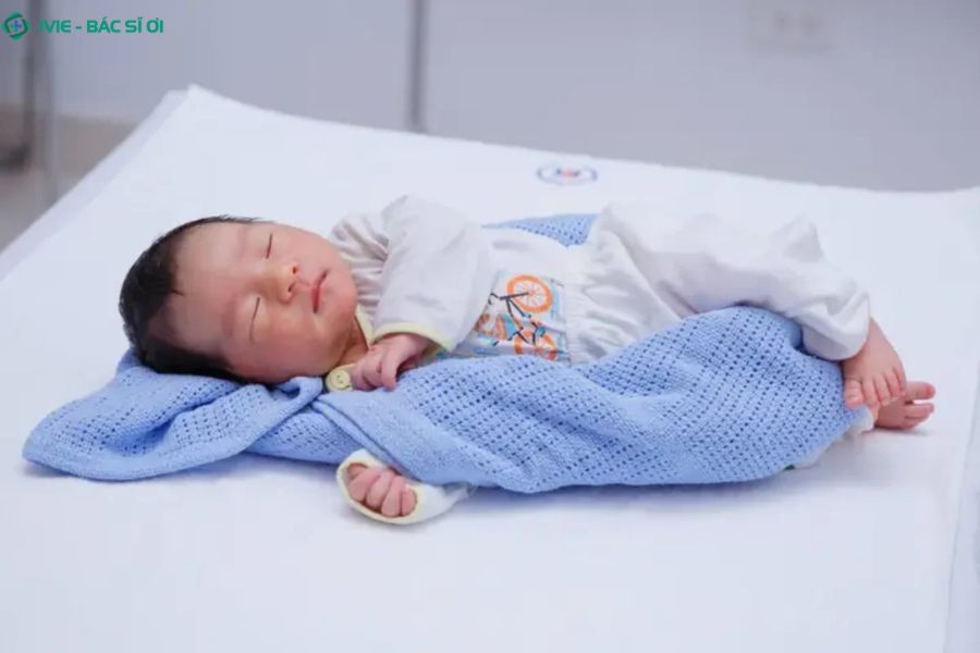 Dấu hiệu nhận biết méo đầu ở trẻ 3 tháng tuổi