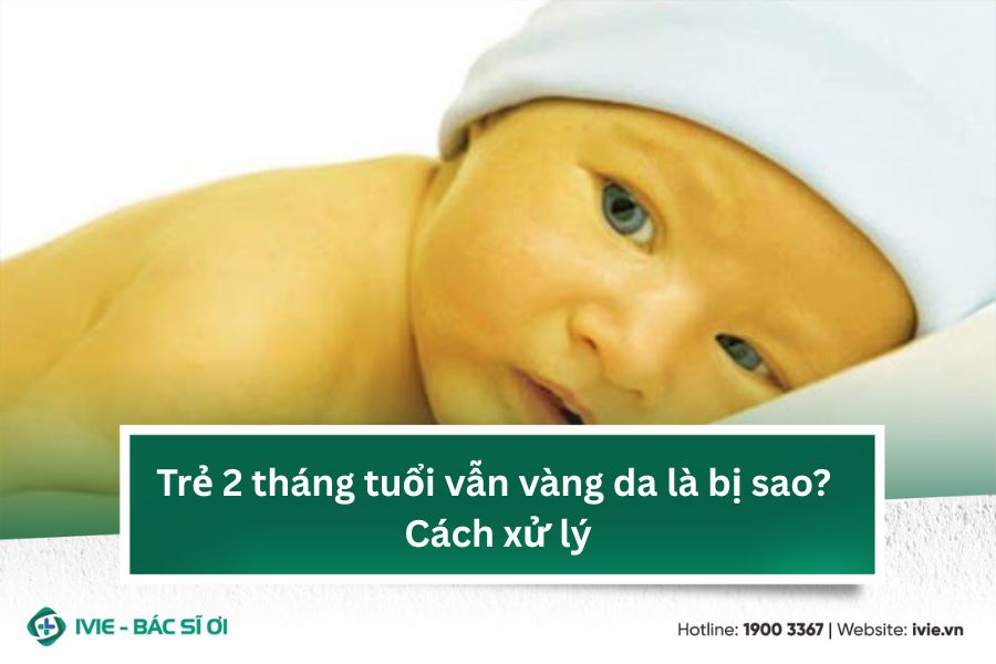 Trẻ 2 tháng tuổi vẫn vàng da là bị sao? Cách xử lý