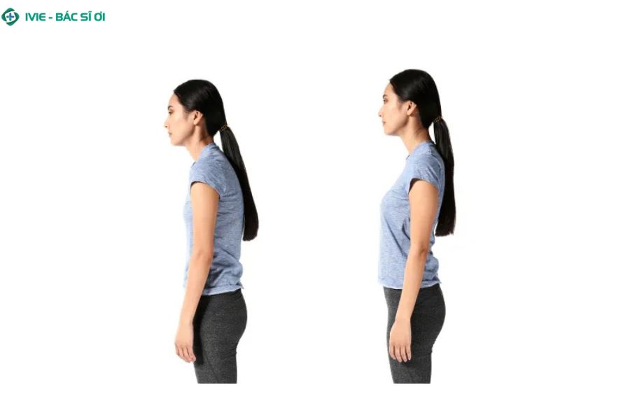 Dấu hiệu nhận biết cổ rùa sớm