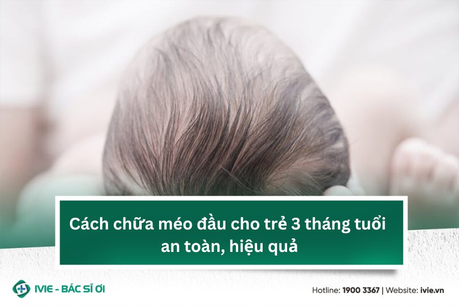 Cách chữa méo đầu cho trẻ 3 tháng tuổi an toàn, hiệu quả
