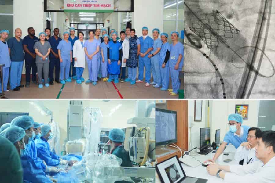 Bảng giá siêu âm tim bệnh viện Bạch Mai được niêm yết công khai minh bạch theo quy định của Bộ Y tế