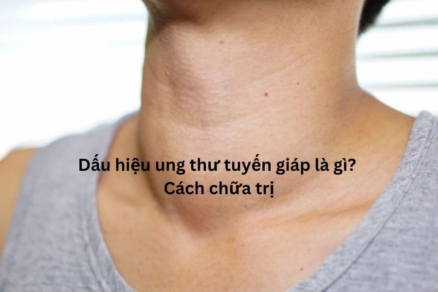 Dấu hiệu ung thư tuyến giáp là gì? Cách chữa trị