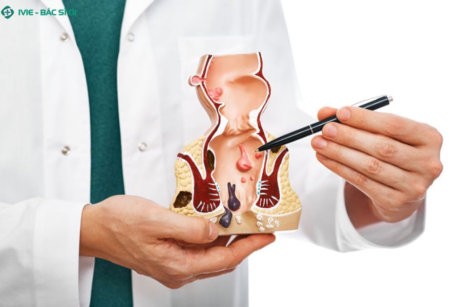 Các trường hợp cần tránh hoàn toàn quan hệ hậu môn khi bị trĩ