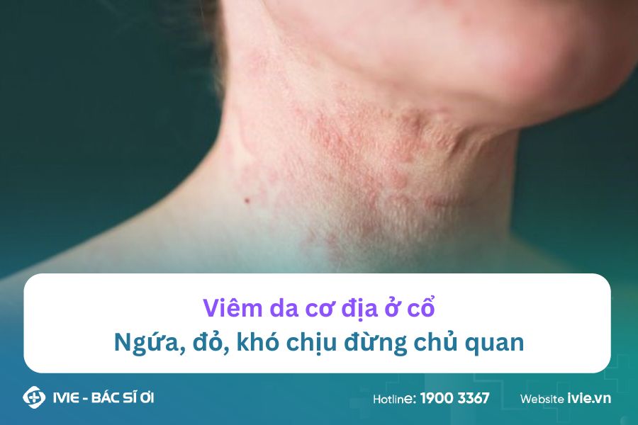Viêm da cơ địa ở cổ - Ngứa, đỏ, khó chịu đừng chủ quan
