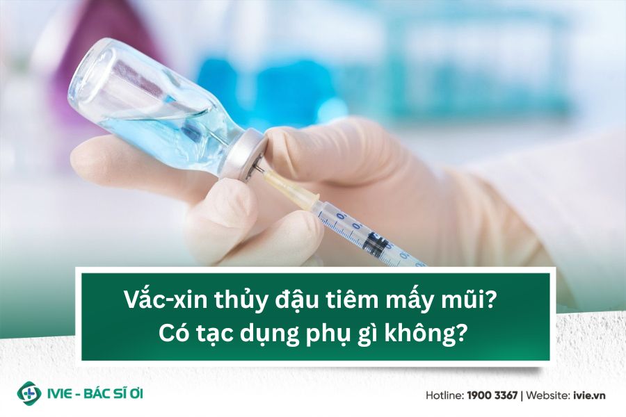 Vắc-xin thủy đậu tiêm mấy mũi? Có tạc dụng phụ gì không?