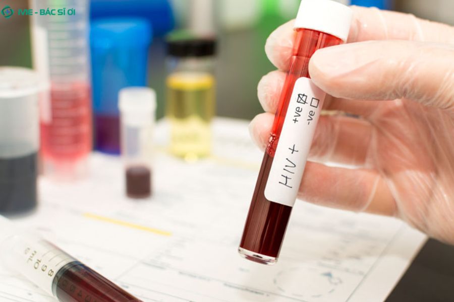 Xét nghiệm máu thường có phát hiện HIV không?