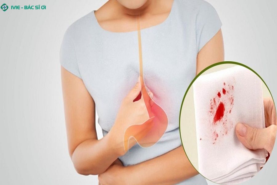 Dấu hiệu xuất huyết dạ dày bạn cần đi khám ngay