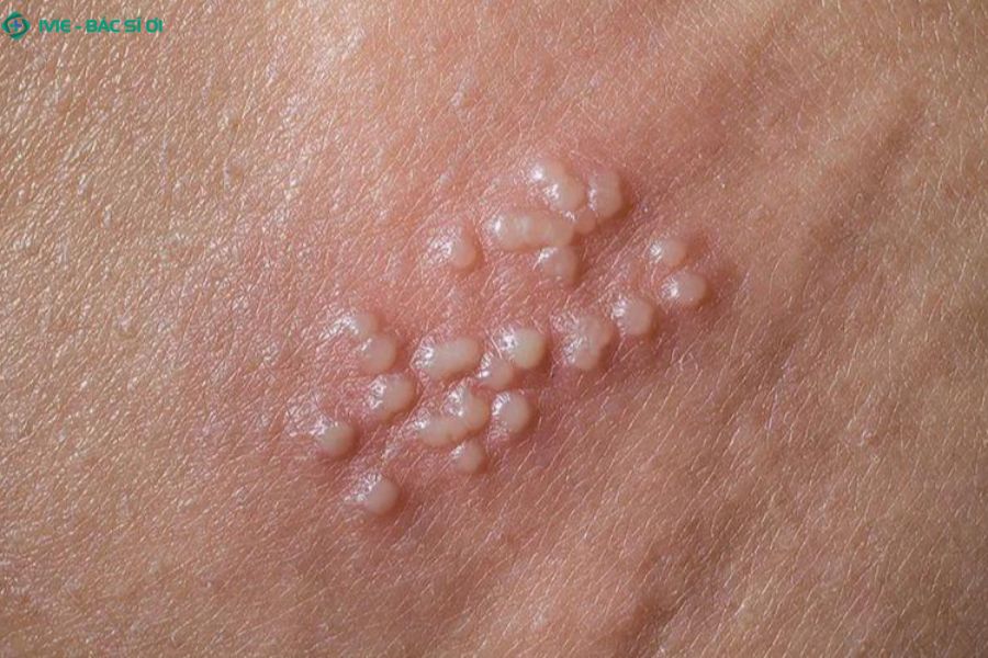 Nhiều bạn trẻ cảm thấy lo lắng và đơn độc khi đối mặt với các dấu hiệu bất thường ở cơ quan sinh dục