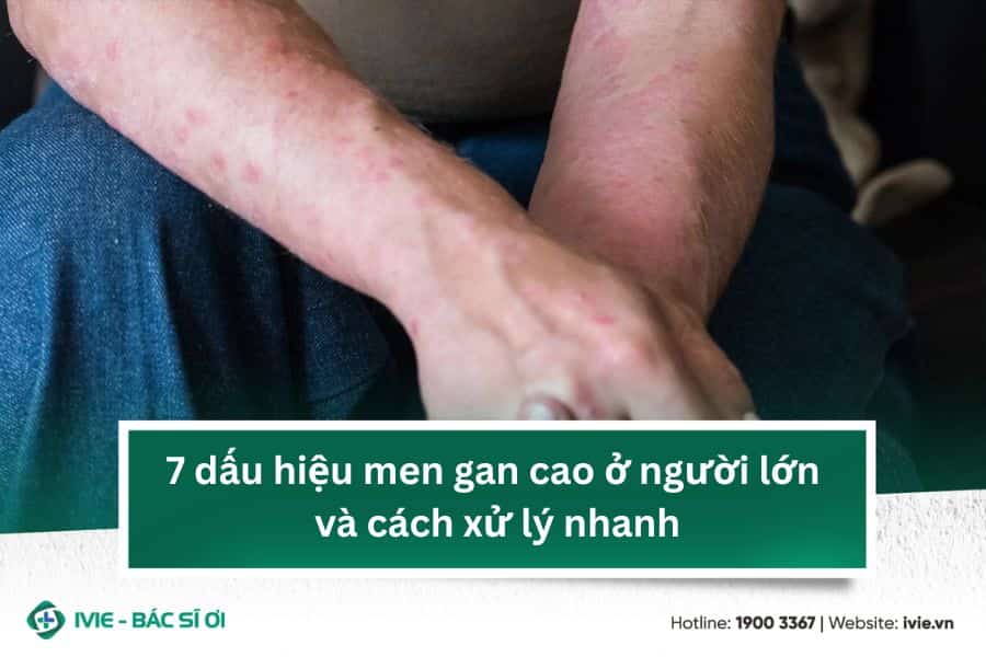 7 dấu hiệu men gan cao ở người lớn và cách xử lý nhanh