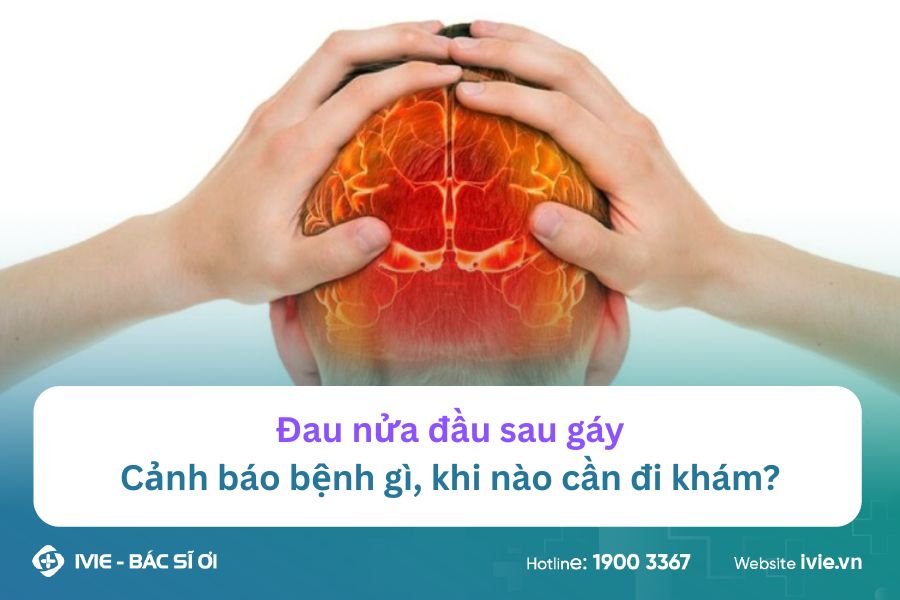 Đau nửa đầu sau gáy - Cảnh báo bệnh gì, khi nào cần đi khám?