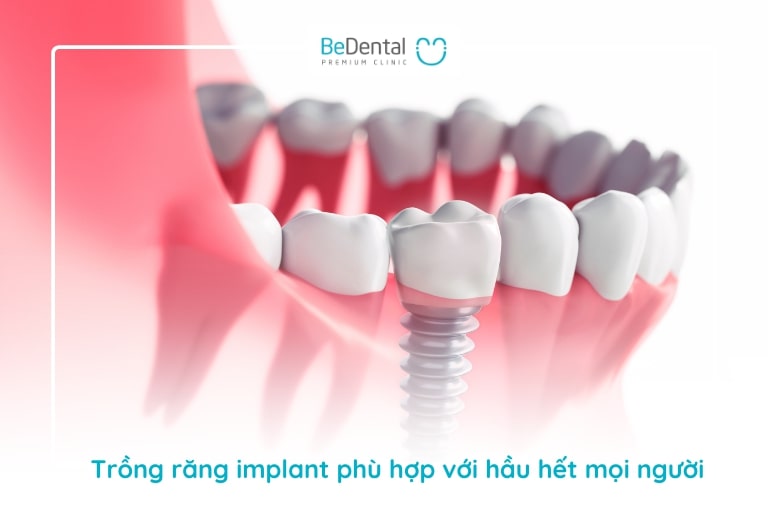 Cấy Trồng implant - Dentium