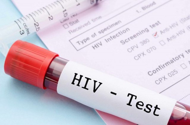 Xét nghiệm HIV tại Phòng khám Vietsing