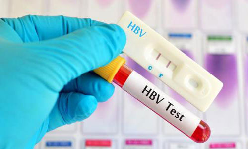 Xét nghiệm Định lượng Virus Viêm gan B (HBV-DNA) PKCK Xét nghiệm Việt