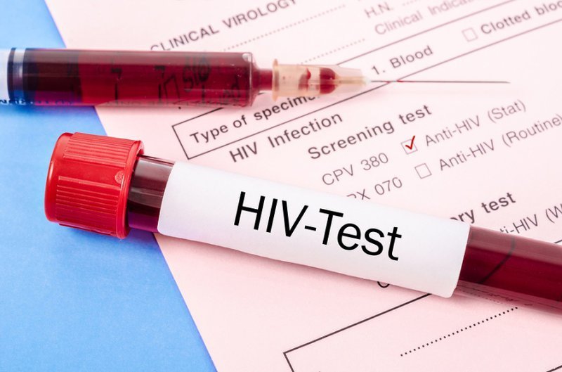 Xét nghiệm HIV - Test Nhanh