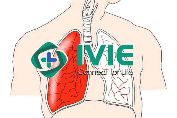 3 Bệnh viện khám phổi uy tín Hà Nội