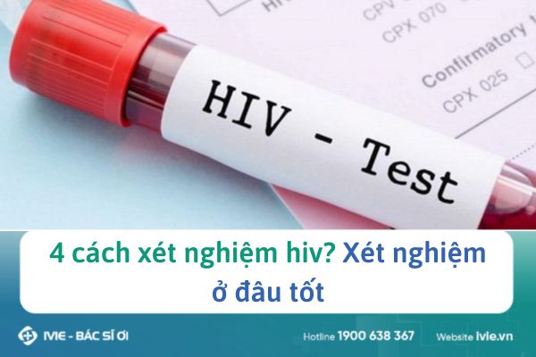 4 cách xét nghiệm hiv? Xét nghiệm ở đâu