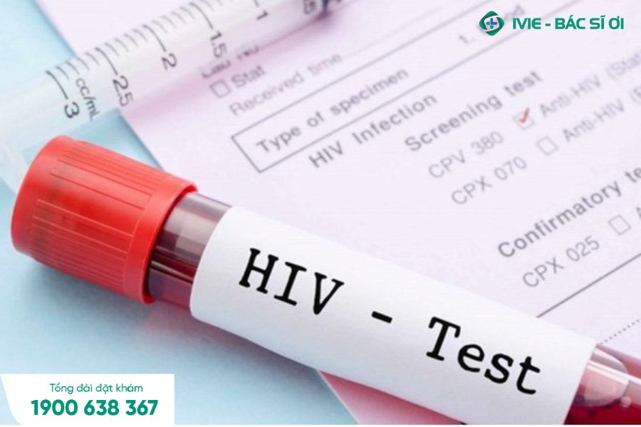 Có 4 phương pháp xét nghiệm HIV 