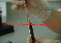Chỉ số LDL-Cholesterol trong máu là gì?