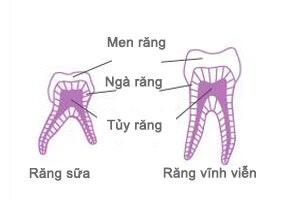 Điều trị tuỷ Răng sữa