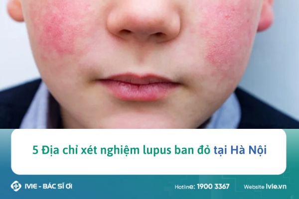 5 Địa chỉ xét nghiệm lupus ban đỏ tại Hà Nội