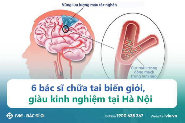 6 bác sĩ chữa tai biến giỏi, giàu kinh nghiệm tại Hà Nội