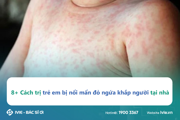 8+ Cách trị trẻ em bị nổi mẩn đỏ ngứa khắp người tại nhà