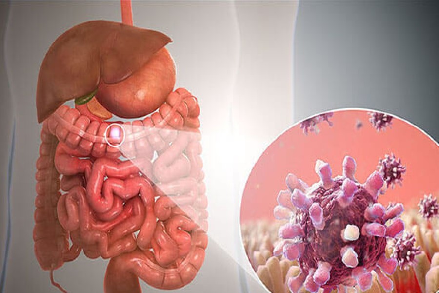 Adenovirus tấn công vào dạ dày, ruột