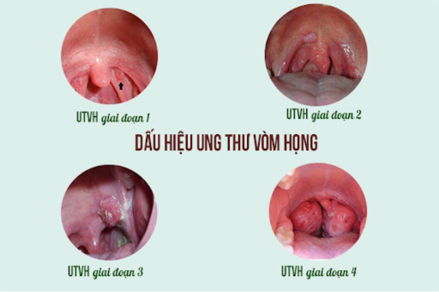 Bác sĩ Nguyễn Danh Quỳnh có thế mạnh trong khám và điều trị bệnh lý Tai mũi họng - Ung bướu