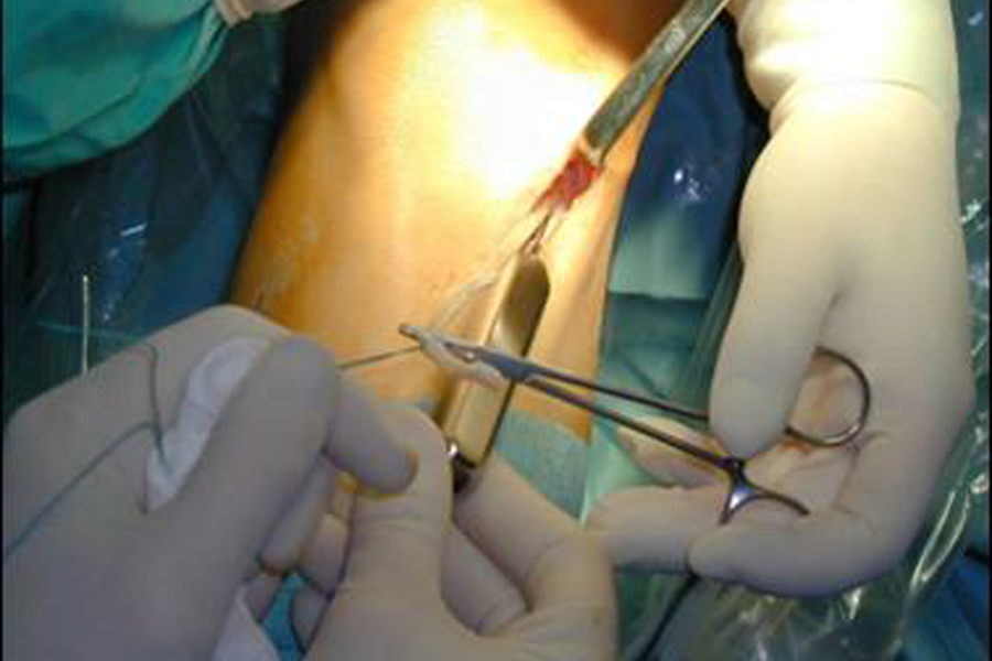 Ca phẫu thuật chấn thương tại bệnh viện Việt Đức