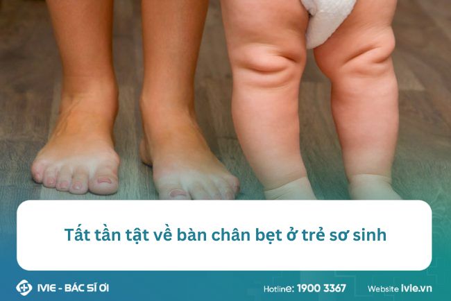 Tất tần tật về bàn chân bẹt ở trẻ sơ sinh