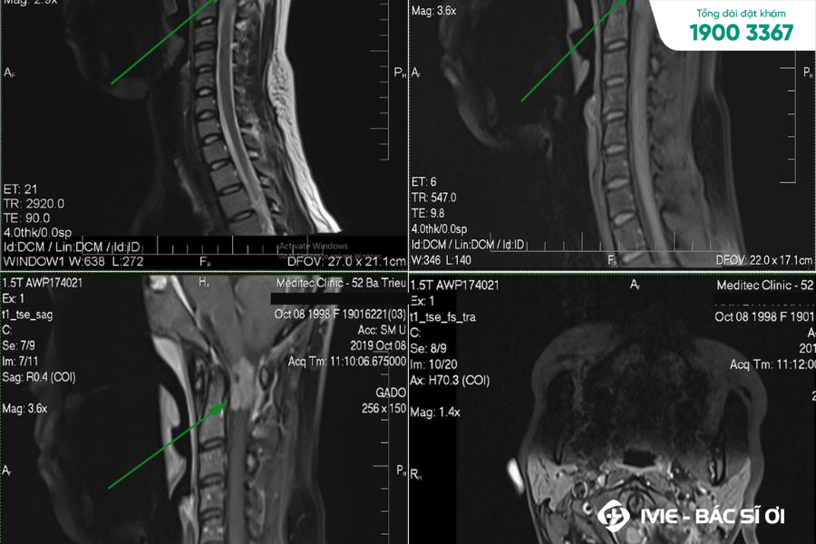 Chi phí chụp MRI cột sống còn phụ thuộc vào nhiều yếu tố như trang thiết bị, chuyên môn bác sĩ