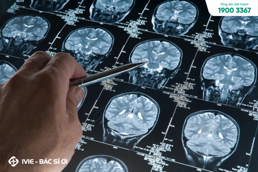 Giá chụp MRI não thường dao động từ 1.500.000đ - 5.000.000đ