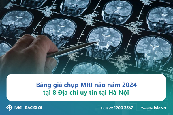Bảng giá chụp MRI não năm 2024 tại 8 Địa chỉ uy tín tại Hà...