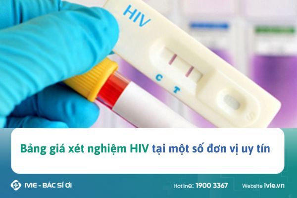 Bảng giá xét nghiệm HIV tại một số đơn vị uy tín