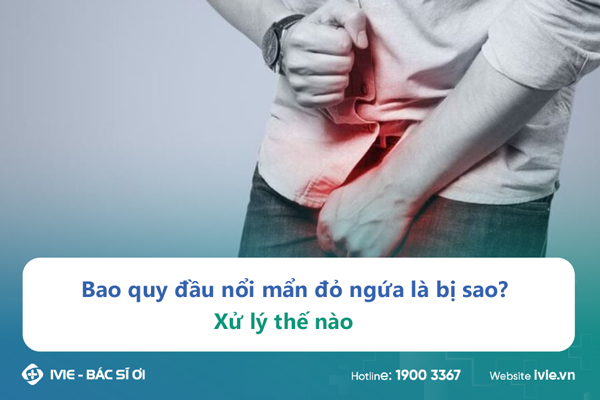 Bao quy đầu nổi mẩn đỏ ngứa là bị sao? Xử lý thế nào